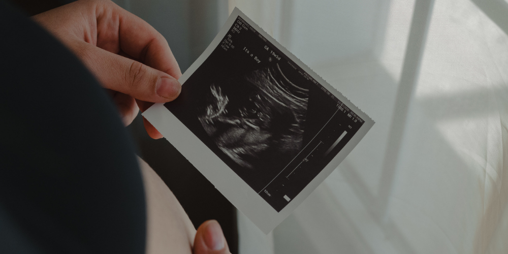 Understanding the Different Types of Ultrasound Paper Glossy, Standard, and Color Explained