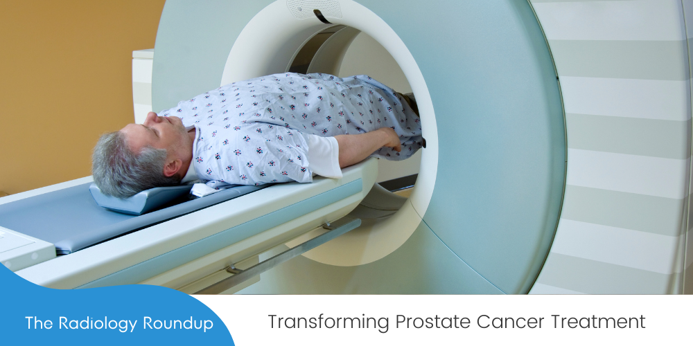 Transforming Prostate Cancer Treatment