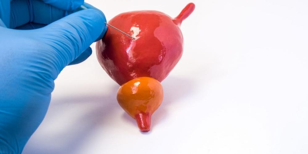 Endocavity biopsy