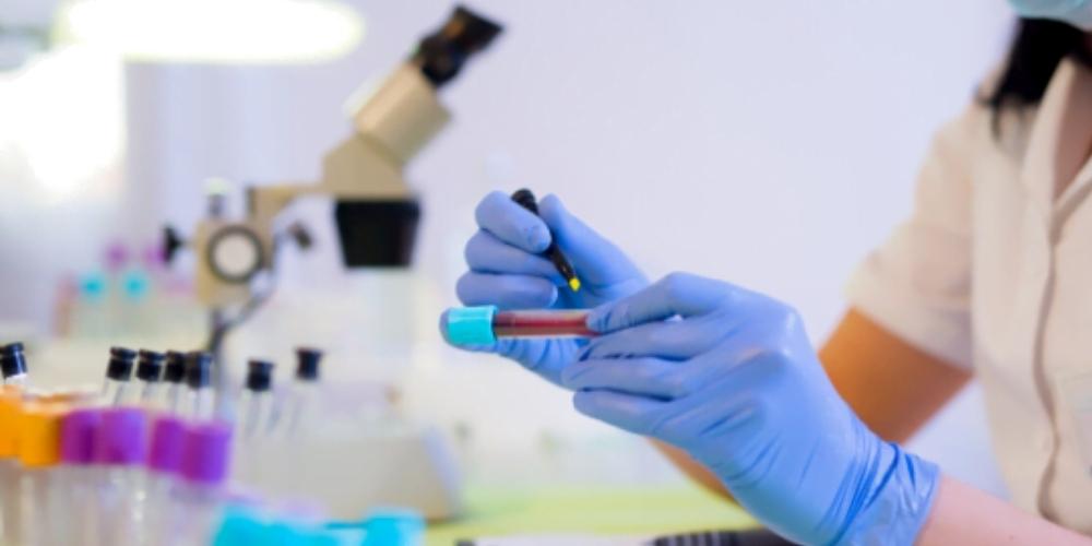 Improving outcomes for sepsis survivors