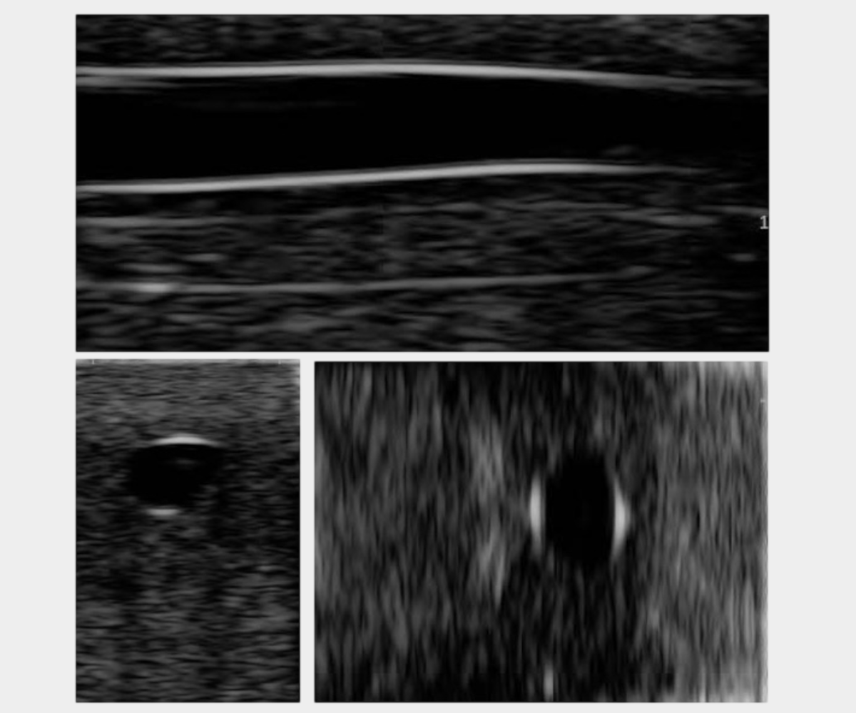 Ultrasound images of the arm training phantom