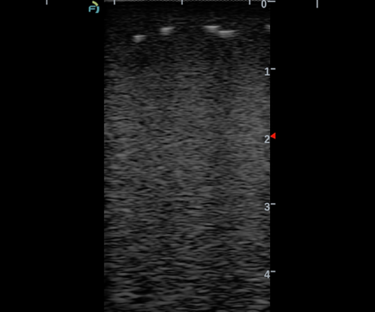 Clear ultrasound image of the face training phantom