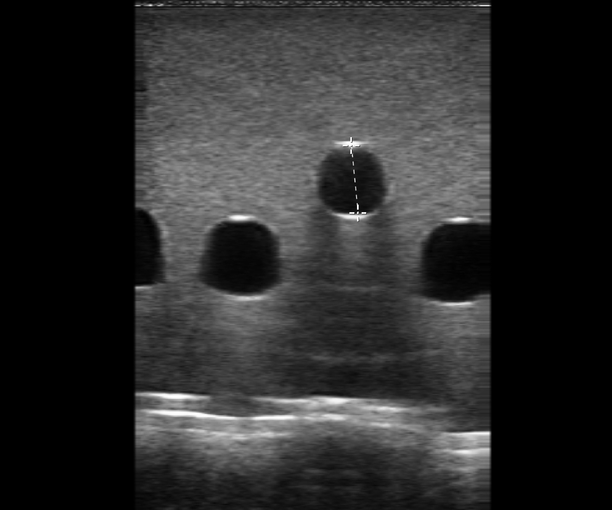 The medical imaging professional is measuring of the vessels thanks to ultrasound images of the vascular access training phantom - 5 vessels