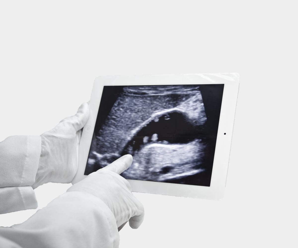 Clear Sterile Tablet Cover