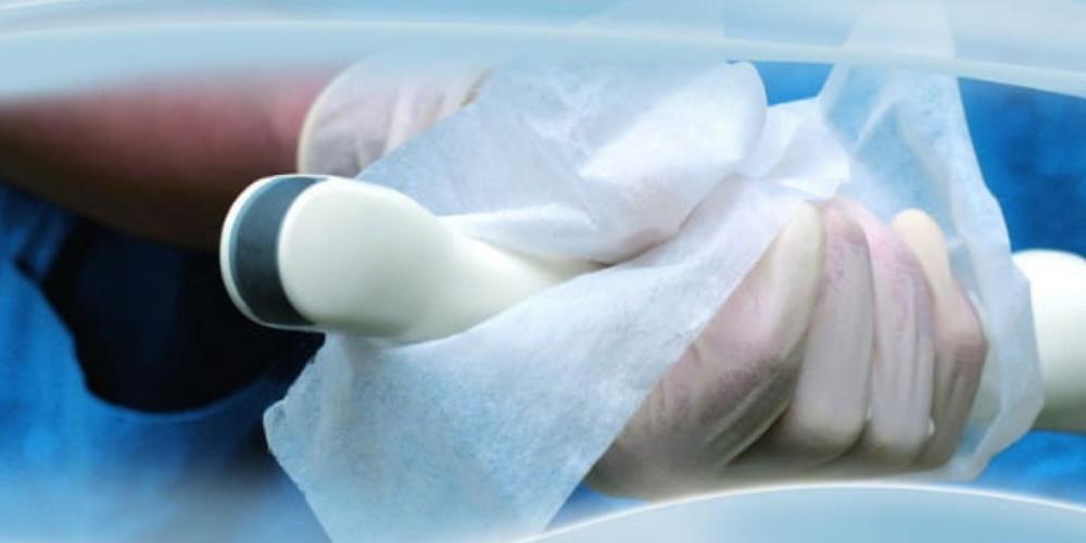 How to best protect your endocavity ultrasound probe