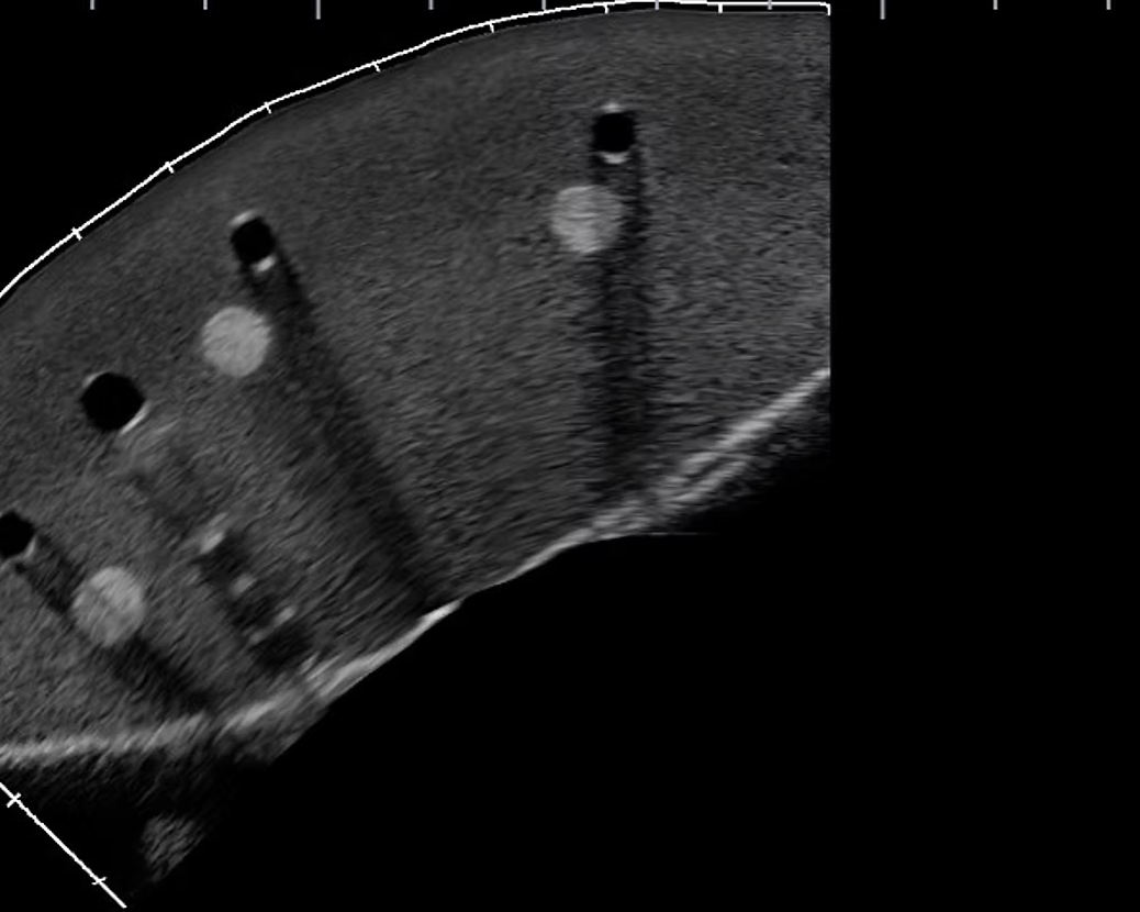 A grayscale ultrasound or radiographic cross-sectional view showing a curved internal structure with multiple dark and light circular/oval regions on a black background.