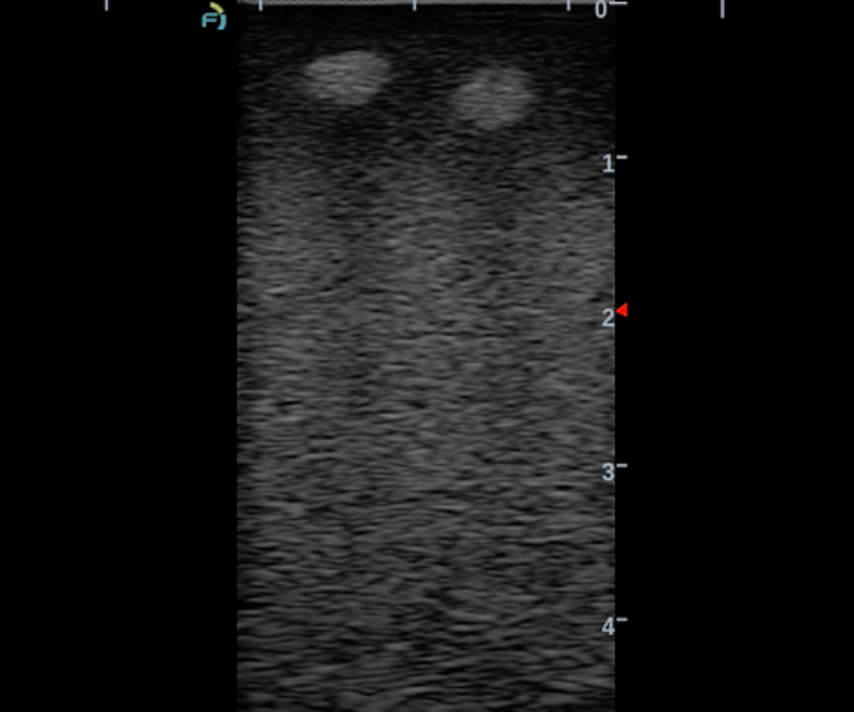 Another ultrasound image of the face training phantom 