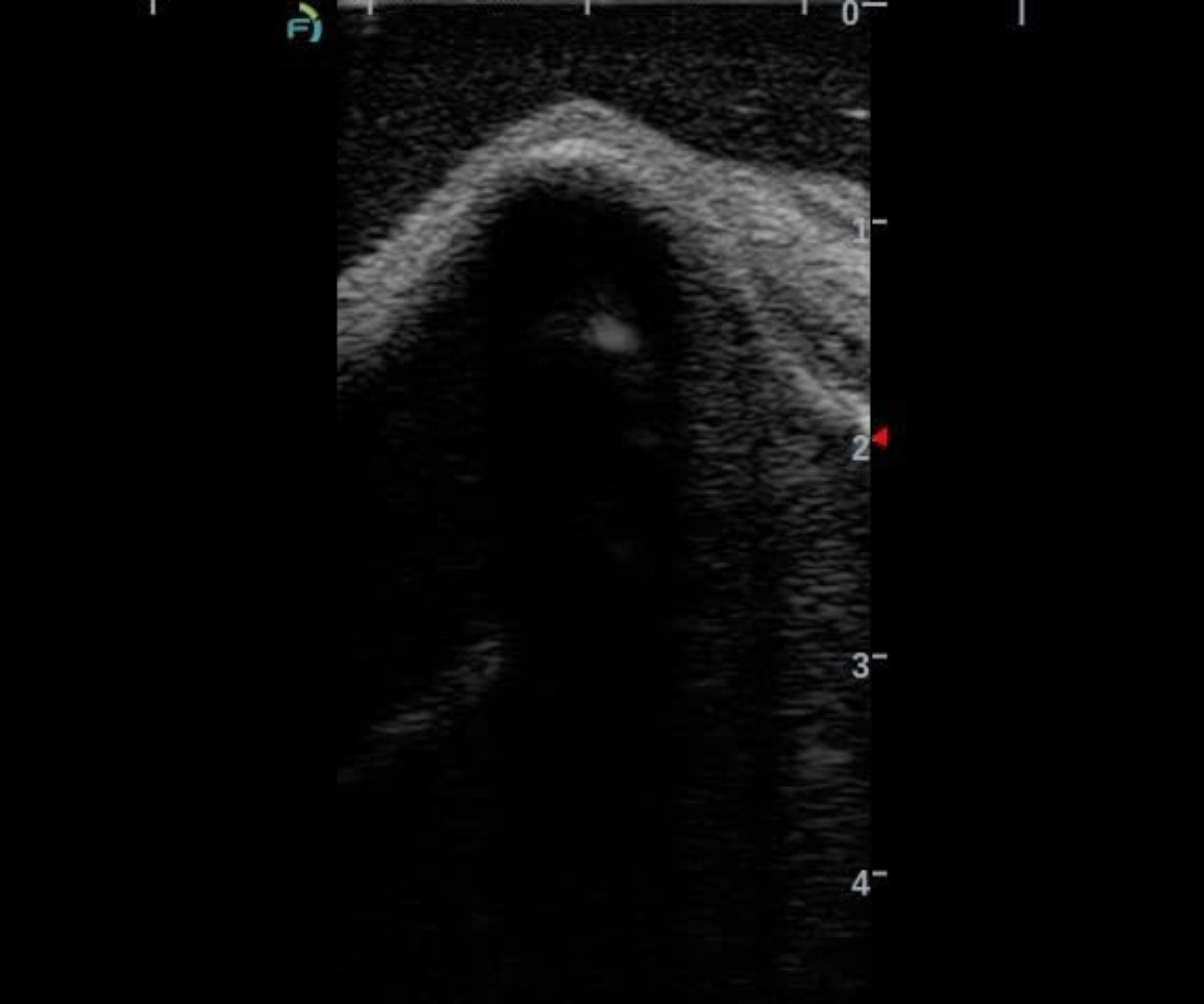 A clear ultrasound image of the knee training phantom