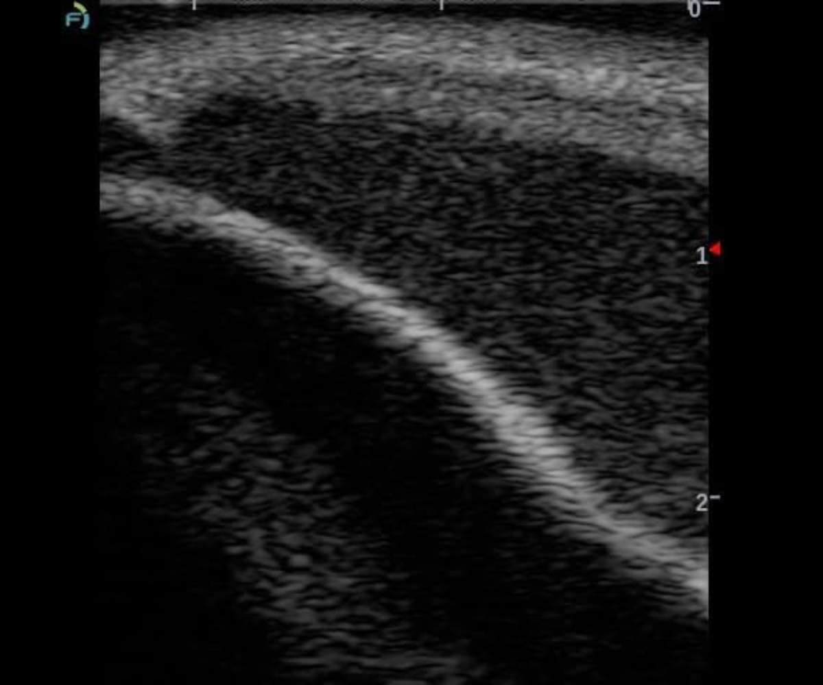 Ultrasound image of the knee training phantom