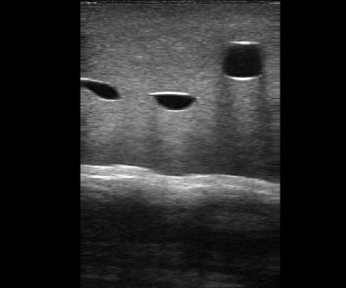 Other set of ultrasound images of the vascular access training phantom - 5 vessels