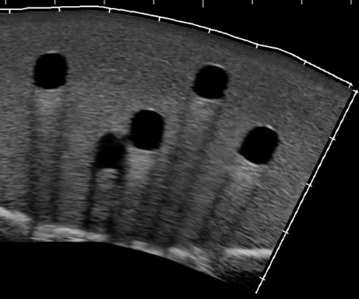 Ultrasound images of the vascular access training phantom - 5 vessels