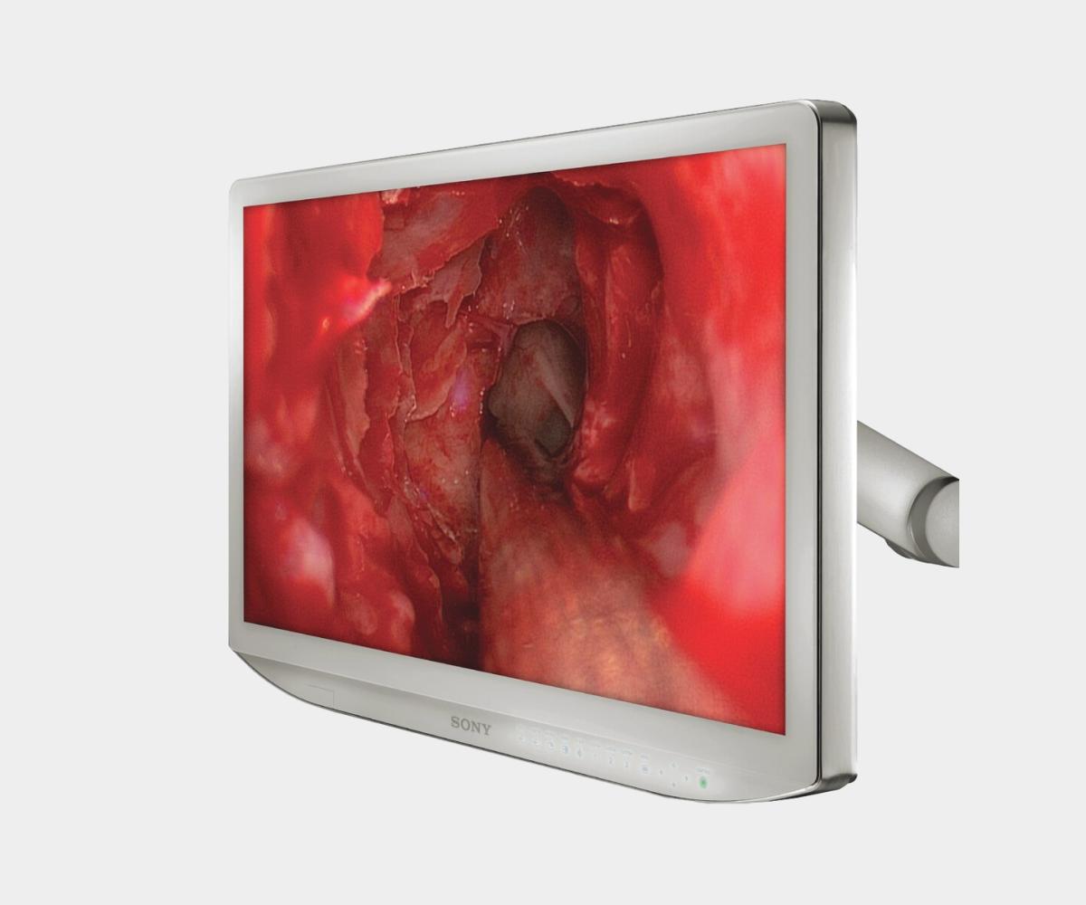 Sony Surgical Monitor Display