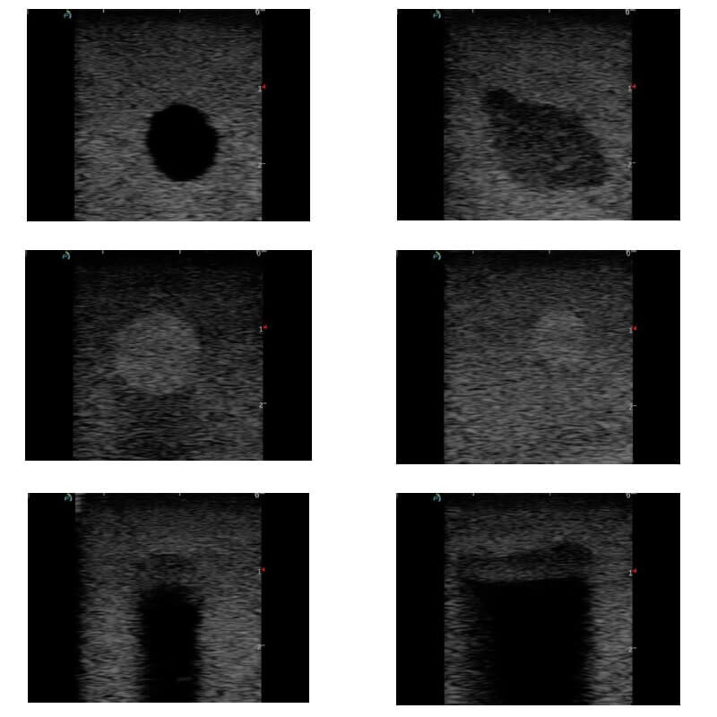 Ultrasound images of breast biopsy training phantom