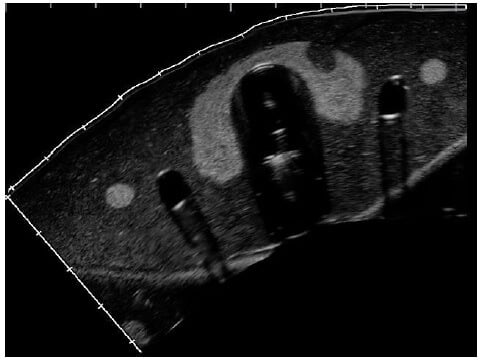 Ultrasound images of thyroid phantom